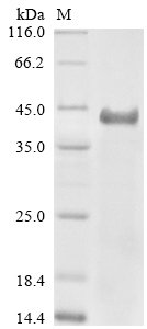 Human Serine--pyruvate aminotransferase (AGXT) Recombinant Protein, N-His, aa 1–392, Yeast, Homo sapiens (Human), Yeast, N-terminal 6xHis-tagged, 44.3 kDa, purity >≥ 85% as determined by SDS-PAGE.
