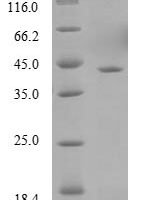 Zaire ebolavirus Polymerase cofactor VP35 (VP35) Recombinant Protein, N-10His/C-Myc, aa 1–340, E.coli - BioCrest Sci