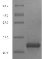 Human Proepiregulin (EREG), partial Recombinant Protein - BioCrest Sci