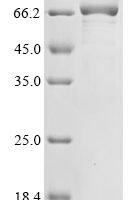 Human Endoribonuclease ZC3H12A (ZC3H12A) Recombinant Protein - BioCrest Sci
