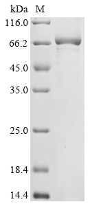 Human Endoribonuclease ZC3H12A (ZC3H12A) Recombinant Protein, Homo sapiens (Human), E.coli, N-terminal 6xHis-tagged, 69.8 kDa, purity >≥ 85% as determined by SDS-PAGE.