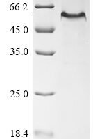 Mouse EGF-containing fibulin-like extracellular matrix protein 1 (Efemp1) Recombinant Protein, N-10His/C-Myc - BioCrest Sci
