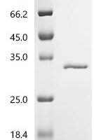 Mycobacterium tuberculosis Uracil phosphoribosyltransferase (upp) Recombinant Protein - BioCrest Sci