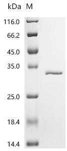 Mycobacterium tuberculosis Uracil phosphoribosyltransferase (upp) Recombinant Protein, Mycobacterium tuberculosis (strain ATCC 25177 / H37Ra), E.coli, C-terminal 6xHis-tagged, 28.8 kDa, purity >≥ 95% as determined by SDS-PAGE.
