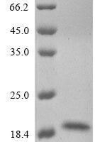 Enterovirus A71 Genome polyprotein, partial Recombinant Protein - BioCrest Sci