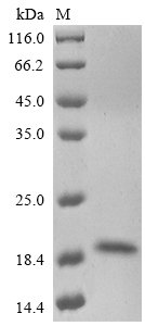 Enterovirus A71 Genome polyprotein, partial Recombinant Protein, Enterovirus A71, E.coli, N-terminal 6xHis-SUMO-tagged, 19.4 kDa, purity >≥ 85% as determined by SDS-PAGE.