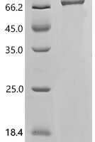Human Thyroid hormone receptor alpha(THRA) Recombinant Protein - BioCrest Sci
