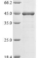Human Artemin (ARTN) Recombinant Protein - BioCrest Sci