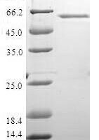 Human DNA repair protein XRCC4 (XRCC4) Recombinant Protein - BioCrest Sci