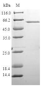 Human DNA repair protein XRCC4 (XRCC4) Recombinant Protein, Homo sapiens (Human), E.coli, N-terminal GST-tagged, 65.3 kDa, purity >≥ 90% as determined by SDS-PAGE.