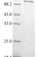 Human Protein mono-ADP-ribosyltransferase PARP12 (PARP12) Recombinant Protein - BioCrest Sci