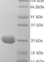 Chicken Riboflavin-binding protein, partial Recombinant Protein, N-His, aa 18–225, Yeast - BioCrest Sci