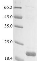 Human Transmembrane protein 132A (TMEM132A), partial Recombinant Protein - BioCrest Sci