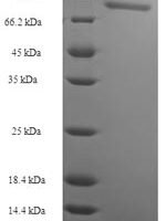 Escherichia coli Ribonucleoside-diphosphate reductase 1 subunit alpha (nrdA) Recombinant Protein - BioCrest Sci