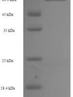 Human AP-2 complex subunit mu (AP2M1) Recombinant Protein, N-His-SUMO - BioCrest Sci