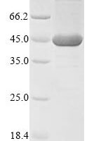 Neisseria meningitidis serogroup C / serotype 2a Quinolinate synthase A (nadA) Recombinant Protein - BioCrest Sci