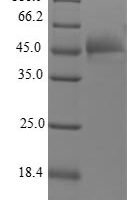 Human Fibroblast growth factor 12 (FGF12) Recombinant Protein - BioCrest Sci