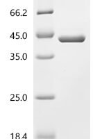 Human Myelin protein P0 (MPZ), partial Recombinant Protein, N-His-GST - BioCrest Sci