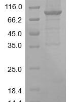 Human Alpha-enolase (ENO1) Recombinant Protein, N-MBP/C-His - BioCrest Sci