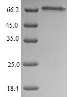 Mouse Septin-9 (Sept9) Recombinant Protein - BioCrest Sci