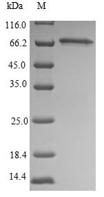 Mouse Septin-9 (Sept9) Recombinant Protein, Mus musculus (Mouse), E.coli, N-terminal 6xHis-tagged, 69.6 kDa, purity >≥ 85% as determined by SDS-PAGE.