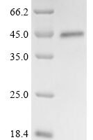 Torque teno virus Probable protein VP2 (ORF2/3) Recombinant Protein - BioCrest Sci