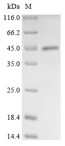 Torque teno virus Probable protein VP2 (ORF2/3) Recombinant Protein, Torque teno virus (isolate Human/Japan/TRM1/1999) (TTV) (Torque teno virus genotype 1a), Baculovirus, N-terminal 10xHis-tagged, 33.1 kDa, purity >≥ 90% as determined by SDS-PAGE.