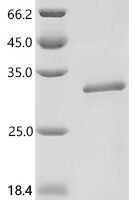 Mouse Secreted phosphoprotein 24 (Spp2) Recombinant Protein, C-His - BioCrest Sci