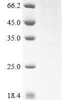 Human Heat shock protein HSP 90-beta (HSP90AB1) Recombinant Protein, C-His - BioCrest Sci