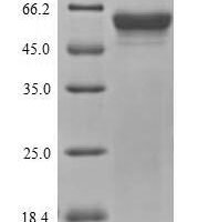 Yersinia pestis Outer membrane protein YopM (yopM) Recombinant Protein - BioCrest Sci