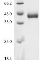 Human Killer cell immunoglobulin-like receptor 3DL3 (KIR3DL3), partial Recombinant Protein, C-10His - BioCrest Sci