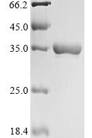 Escherichia coli Cell division protein ZapD (zapD) Recombinant Protein - BioCrest Sci