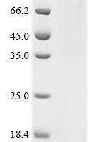 Mouse Transcription regulator protein BACH1 (Bach1), Biotinylated Recombinant Protein - BioCrest Sci