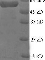 Human Multiple inositol polyphosphate phosphatase 1 (MINPP1) Recombinant Protein, N-GST - BioCrest Sci