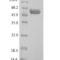 Human Arylsulfatase B (ARSB) Recombinant Protein, N-His, aa 37–533, Yeast - BioCrest Sci