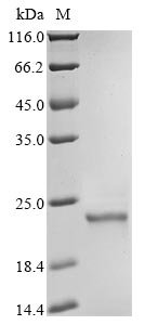 Human Phospholipid hydroperoxide glutathione peroxidase GPX4 (GPX4) (U73S), partial Recombinant Protein, C-10His, Homo sapiens (Human), Yeast, C-terminal 10xHis-tagged, 21.4 kDa, purity >≥ 90% as determined by SDS-PAGE.