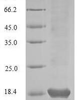 Hepatitis C virus genotype 1a Genome polyprotein, partial Recombinant Protein, C-His-Myc - BioCrest Sci