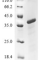 Chicken Low-density lipoprotein receptor-related protein 1 (LRP1), partial Recombinant Protein, N-10His/C-Myc - BioCrest Sci