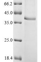 Mouse Cellular communication network factor 6 (Ccn6) Recombinant Protein, N-10His/C-Myc - BioCrest Sci