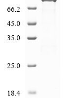 Human Short transient receptor potential channel 4-associated protein (TRPC4AP) Recombinant Protein - BioCrest Sci