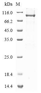 Human Short transient receptor potential channel 4-associated protein (TRPC4AP) Recombinant Protein, Homo sapiens (Human), E.coli, N-terminal 6xHis-tagged, 94.8 kDa, purity >≥ 85% as determined by SDS-PAGE.