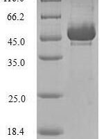 Human Stromelysin-2 (MMP10) Recombinant Protein, N-His, aa 99–476, E.coli - BioCrest Sci