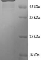 Human Tetratricopeptide repeat protein 1 (TTC1), partial Recombinant Protein - BioCrest Sci