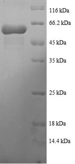Human Tetratricopeptide repeat protein 1 (TTC1), partial Recombinant Protein, Homo sapiens (Human), E.coli, N-terminal GST-tagged, 60.3 kDa, purity >≥ 90% as determined by SDS-PAGE.