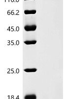 Human coronavirus NL63 Spike glycoprotein (S), partial Recombinant Protein, C-His - BioCrest Sci