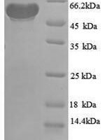 Escherichia coli Pyruvate dehydrogenase [ubiquinone] (poxB), partial Recombinant Protein - BioCrest Sci
