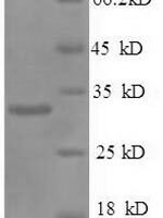 Human Prohibitin 1 (PHB1) Recombinant Protein - BioCrest Sci