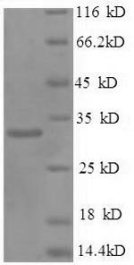 Human Prohibitin 1 (PHB1) Recombinant Protein, Homo sapiens (Human), E.coli, N-terminal 6xHis-tagged, 33.8 kDa, purity >≥ 90% as determined by SDS-PAGE.