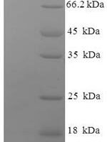 Human Major vault protein (MVP) Recombinant Protein - BioCrest Sci