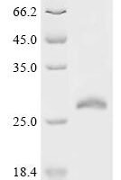 Human Ras-related protein Rab-15 (RAB15) Recombinant Protein - BioCrest Sci